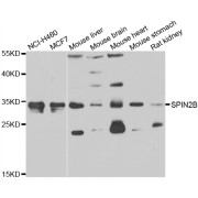 Western blot analysis of extracts of various cell lines, using SPIN2B antibody (abx006485) at 1/1000 dilution.