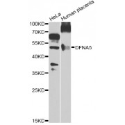Western blot analysis of extracts of various cell lines, using DFNA5 Antibody (abx006488) at 1/1000 dilution.