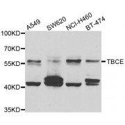 Western blot analysis of extracts of various cell lines, using TBCE antibody (abx006489) at 1/1000 dilution.