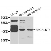 Western blot analysis of extracts of various cell lines, using B3GALNT1 antibody (abx006527) at 1/1000 dilution.