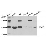 Western blot analysis of extracts of various cell lines, using ACAT2 antibody (abx006564) at 1/1000 dilution.