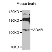 Western blot analysis of extracts of mouse brain, using ADAR antibody (abx006565) at 1/1000 dilution.