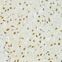 Double-Stranded RNA-Specific Adenosine Deaminase (ADAR) Antibody