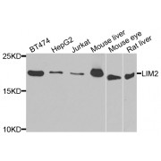 Western blot analysis of extracts of various cell lines, using LIM2 antibody (abx006575) at 1/1000 dilution.