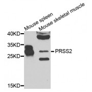 Western blot analysis of extracts of various cell lines, using PRSS2 antibody (abx006579) at 1/1000 dilution.