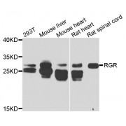 Western blot analysis of extracts of various cell lines, using RGR antibody (abx006580) at 1/1000 dilution.