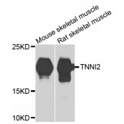 Western blot analysis of extracts of various cell lines, using TNNI2 antibody (abx006583) at 1/1000 dilution.