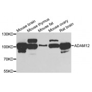 Western blot analysis of extracts of various cell lines, using ADAM12 antibody (abx006584) at 1/1000 dilution.