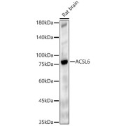 Western blot analysis of Rat brain tissue lysate (25 µg per lane) using ACSL6 antibody (1/2000 dilution) followed by <a href="https://www.abbexa.com/index.php?route=product/search&search=abx005548" target="_blank">abx005548</a> - Goat Anti-Rabbit IgG, H+L (1/10000 dilution) and 3% non-fat dry milk in TBST for blocking.