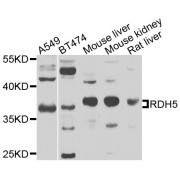 Western blot analysis of extracts of various cell lines, using RDH5 antibody (abx006603) at 1/1000 dilution.