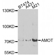 Western blot analysis of extracts of various cell lines, using AMOT antibody (abx006609) at 1/1000 dilution.