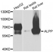 Western blot analysis of extracts of various cell lines, using ALPP antibody (abx006623) at 1/1000 dilution.