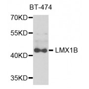 Western blot analysis of extracts of BT-474 cells, using LMX1B antibody (abx006624) at 1/1000 dilution.