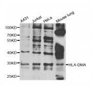 Western blot analysis of extracts of various cell lines, using HLA-DMA antibody (abx006629) at 1/1000 dilution.