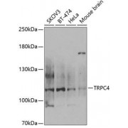 Western blot analysis of extracts of various cell lines, using TRPC4 antibody (1/1000 dilution).