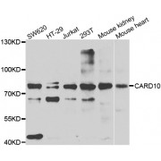 Western blot analysis of extracts of various cell lines, using CARD10 antibody (abx006645) at 1/1000 dilution.