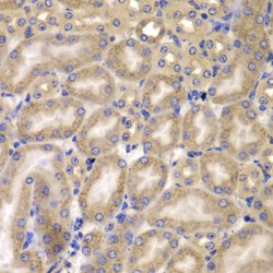 Caspase Recruitment Domain-Containing Protein 10 (CARD10) Antibody