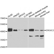 Western blot analysis of extracts of various cell lines, using ERGIC2 antibody (abx006646) at 1/1000 dilution.