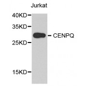 Western blot analysis of extracts of Jurkat cells, using CENPQ antibody (abx006673) at 1/1000 dilution.