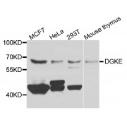 Western blot analysis of extracts of various cell lines, using DGKE antibody (abx006675) at 1/1000 dilution.