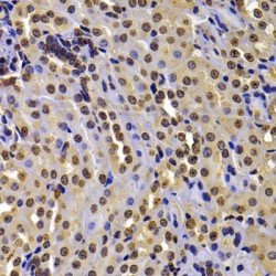 Wolf-Hirschhorn Syndrome Candidate 1 Protein (WHSC1) Antibody