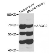 Western blot analysis of extracts of various cell lines, using ABCG2 antibody (abx006789) at 1/1000 dilution.