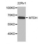 Western blot analysis of extracts of 22Rv1 cells, using MTDH antibody (abx006805) at 1/1000 dilution.