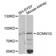 Western blot analysis of extracts of various cell lines, using SCNN1G antibody (abx006807) at 1/1000 dilution.