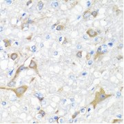 Immunohistochemistry of paraffin-embedded rat brain using IL22 antibody (abx006813) at dilution of 1/100 (40x lens).
