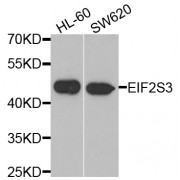 Western blot analysis of extracts of various cell lines, using EIF2S3 antibody (abx006825) at 1/1000 dilution.
