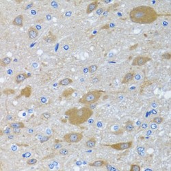 Eukaryotic Translation Initiation Factor 2 Subunit 3 (EIF2S3) Antibody