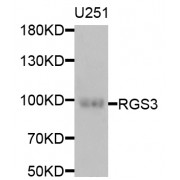 Western blot analysis of extracts of U-251MG cells, using RGS3 antibody (abx006835) at 1/1000 dilution.