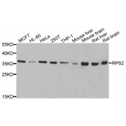 Western blot analysis of extracts of various cell lines, using RPS2 antibody (abx006836) at 1/1000 dilution.