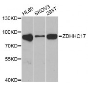 Western blot analysis of extracts of various cell lines, using ZDHHC17 antibody (abx006842) at 1/1000 dilution.