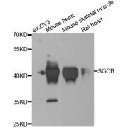 Western blot analysis of extracts of various cell lines, using SGCB antibody (abx006869) at 1/1000 dilution.