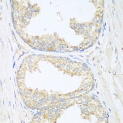 Sarcoglycan Beta (SGCB) Antibody