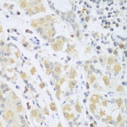 Sarcoglycan Beta (SGCB) Antibody