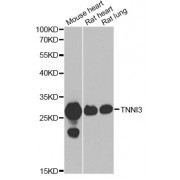 Western blot analysis of extracts of various cell lines, using TNNI3 antibody (abx006874) at 1/1000 dilution.