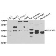 Western blot analysis of extracts of various cell lines, using NDUFAF5 antibody (abx006901) at 1/1000 dilution.