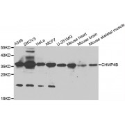 Western blot analysis of extracts of various cell lines, using CHMP4B antibody (abx006940) at 1/1000 dilution.