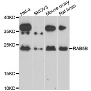 Western blot analysis of extracts of various cell lines, using RAB5B antibody (abx006959) at 1/1000 dilution.