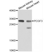 Western blot analysis of extracts of various cell lines, using PCGF3 antibody (abx006967) at 1/1000 dilution.