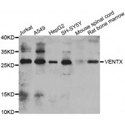 Western blot analysis of extracts of various cell lines, using VENTX antibody (abx006973) at 1/1000 dilution.
