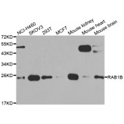 Western blot analysis of extracts of various cell lines, using RAB1B antibody (abx007007) at 1/1000 dilution.