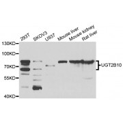 Western blot analysis of extracts of various cell lines, using µgT2B10 antibody (abx007027) at 1/1000 dilution.