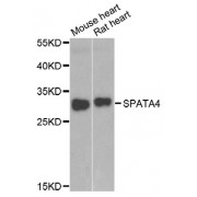Western blot analysis of extracts of various cell lines, using SPATA4 antibody (abx007031) at 1/1000 dilution.