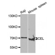 Western blot analysis of extracts of various cell lines, using CEL antibody (abx007036) at 1/1000 dilution.