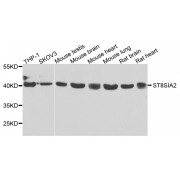 Western blot analysis of extracts of various cell lines, using ST8SIA2 antibody (abx007050) at 1/1000 dilution.