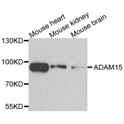 Western blot analysis of extracts of various cell lines, using ADAM15 antibody (abx007052) at 1/500 dilution.