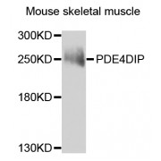 Western blot analysis of extracts of mouse skeletal muscle, using PDE4DIP antibody (abx007058) at 1/1000 dilution.